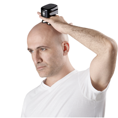 Bald man using a Pitbull head shaver on the top of his head